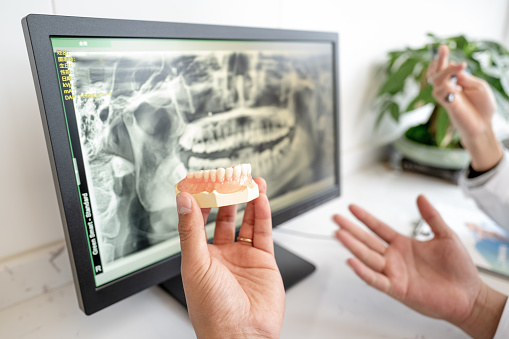 Especialização em prótese dentária: o caminho para liderar a reabilitação oral