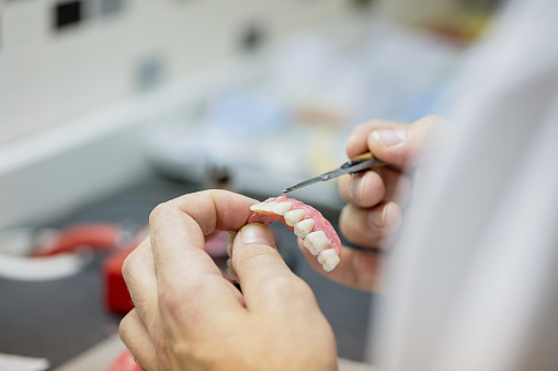 Especialização em Prótese Dentária: como funciona, quanto custa e como escolher o curso