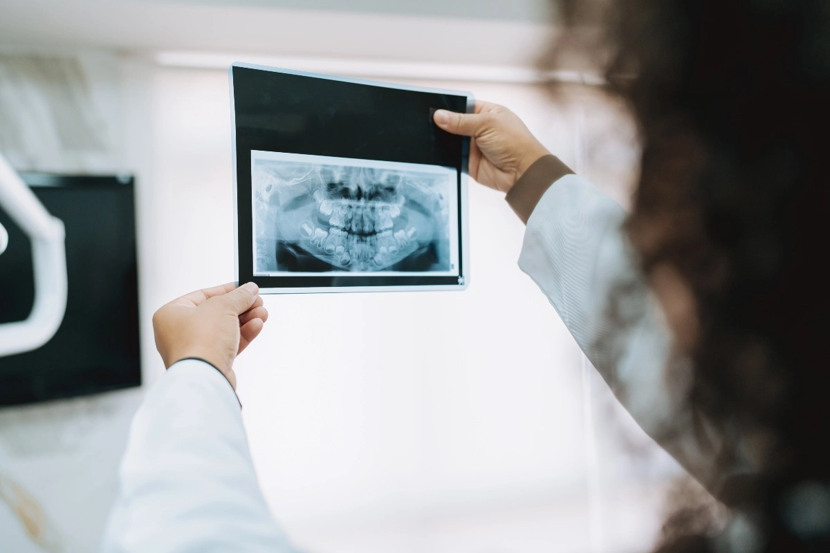 radiologia-odontologica-saiba-tudo