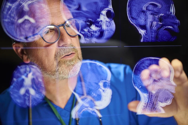 Médico analisando exames de ressonância magnética do cérebro em tela digital