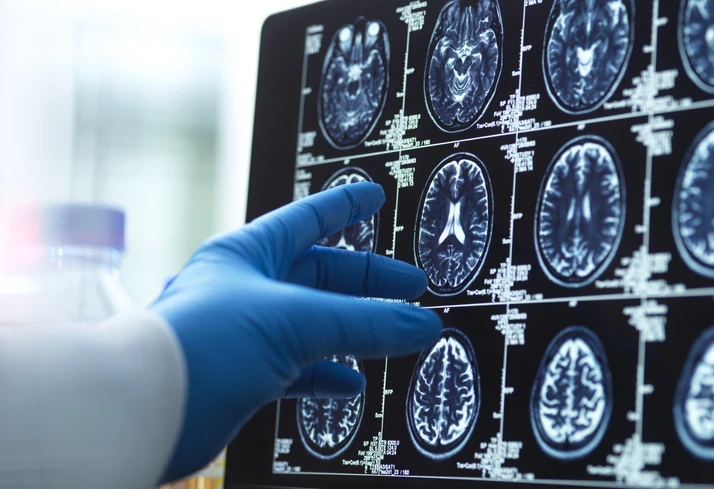 Médico analisando imagens de ressonância magnética do cérebro em monitor
