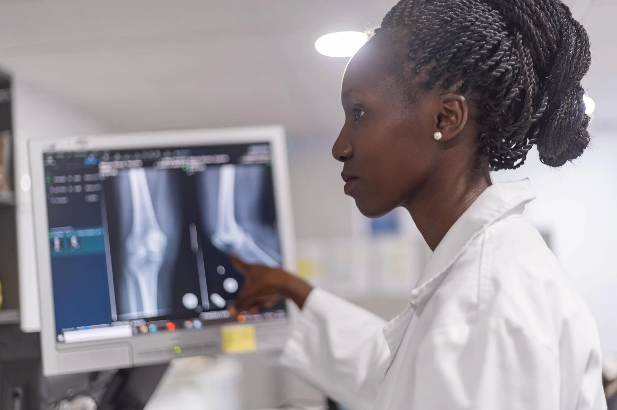 Médica analisando radiografia de joelho em monitor de computador no hospital